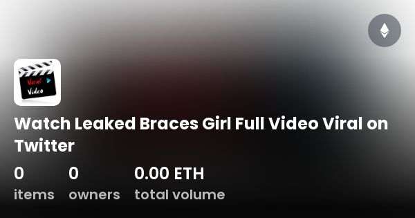 Watch Leaked Braces Girl Full Video Viral On Twitter Collection OpenSea