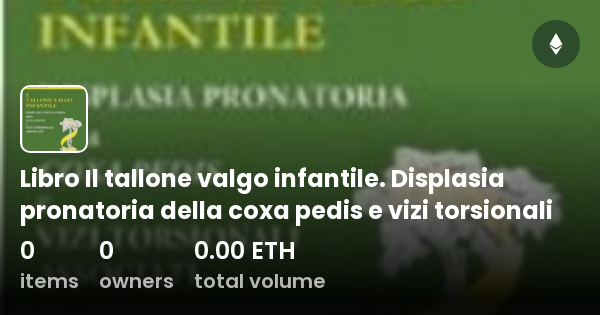 Libro Il Tallone Valgo Infantile Displasia Pronatoria Della Coxa Pedis E Vizi Torsionali